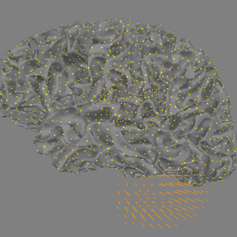 left cerebellum volume source