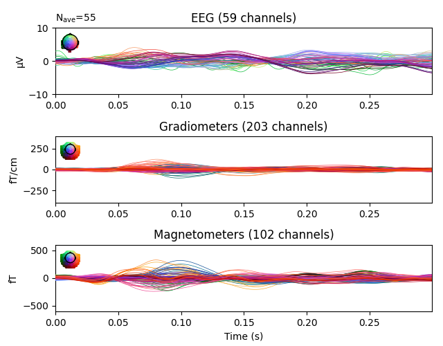 EEG (59 channels), Gradiometers (203 channels), Magnetometers (102 channels)