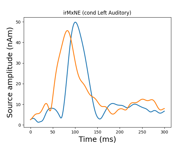 irMxNE (cond Left Auditory)