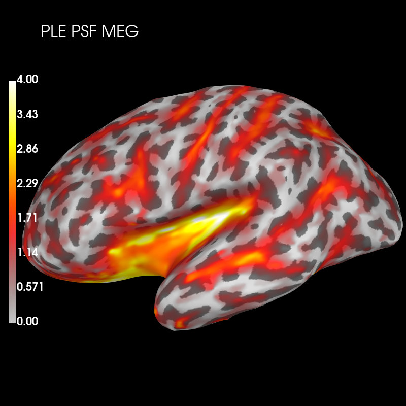 resolution metrics eegmeg