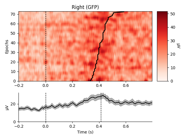 Right (GFP)