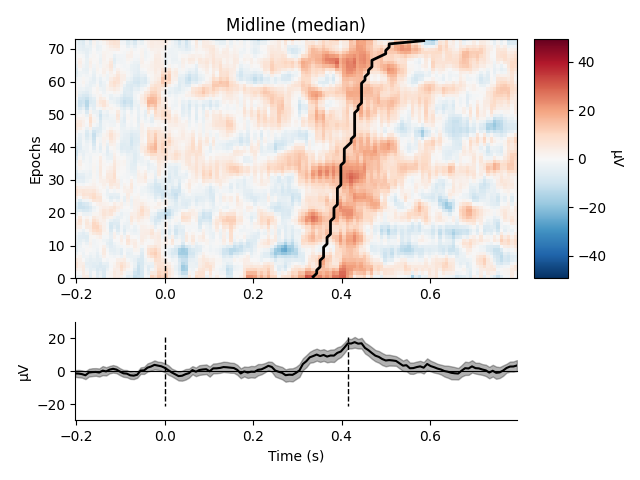 Midline (median)