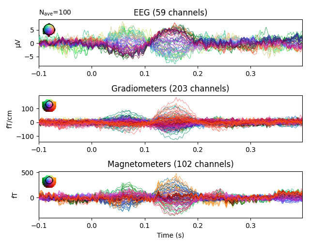 EEG (59 channels), Gradiometers (203 channels), Magnetometers (102 channels)