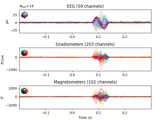 EEG (59 channels), Gradiometers (203 channels), Magnetometers (102 channels)