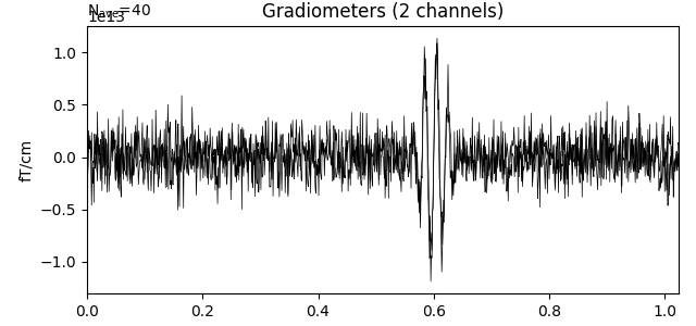 Gradiometers (2 channels)