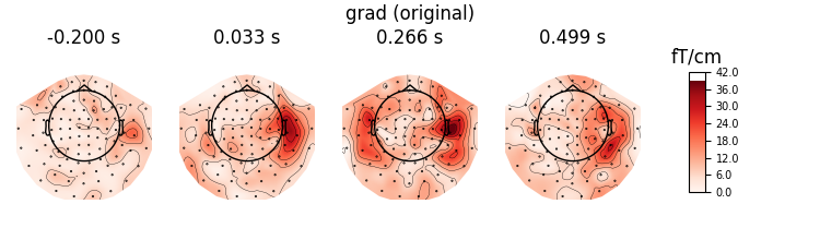 grad (original), -0.200 s, 0.033 s, 0.266 s, 0.499 s, fT/cm