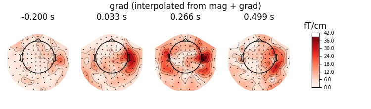 grad (interpolated from mag + grad), -0.200 s, 0.033 s, 0.266 s, 0.499 s, fT/cm