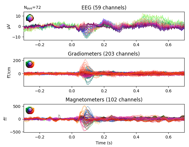 EEG (59 channels), Gradiometers (203 channels), Magnetometers (102 channels)