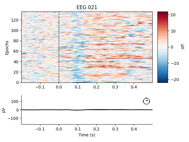 EEG 021