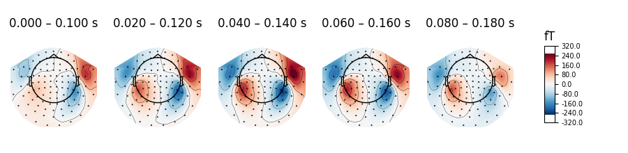 0.000 – 0.100 s, 0.020 – 0.120 s, 0.040 – 0.140 s, 0.060 – 0.160 s, 0.080 – 0.180 s, fT