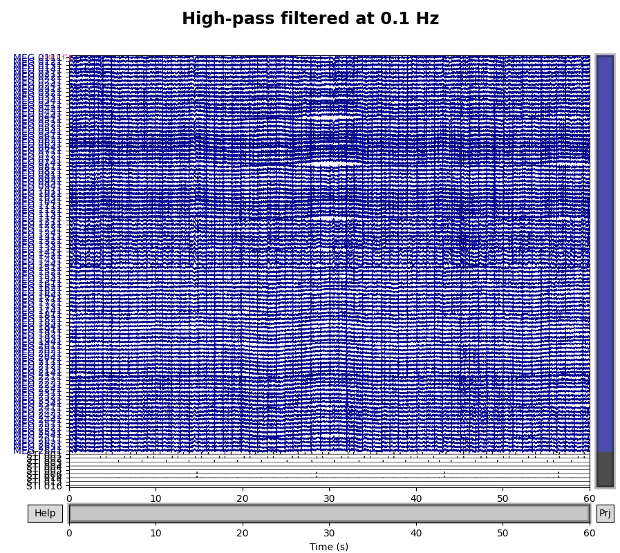 High-pass filtered at 0.1 Hz