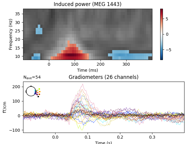 Induced power (MEG 1443), Gradiometers (26 channels)