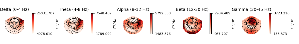 Delta (0-4 Hz), Theta (4-8 Hz), Alpha (8-12 Hz), Beta (12-30 Hz), Gamma (30-45 Hz)