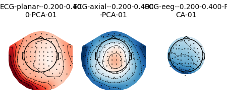 ECG-planar--0.200-0.40 0-PCA-01, ECG-axial--0.200-0.400 -PCA-01, ECG-eeg--0.200-0.400-P CA-01