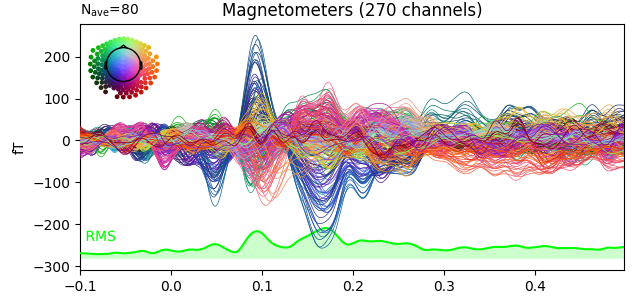 Magnetometers (270 channels)