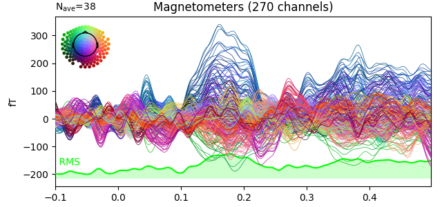 Magnetometers (270 channels)