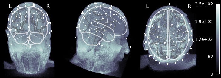 70 eeg mri coords