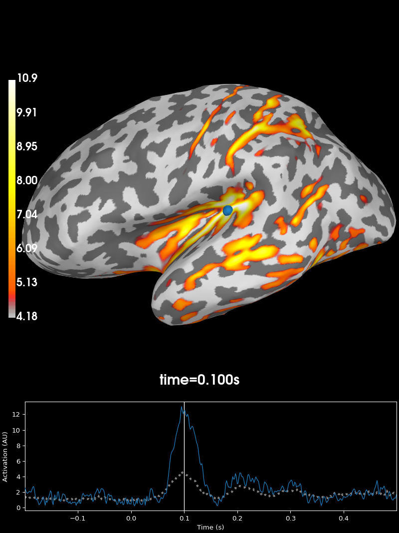 70 eeg mri coords