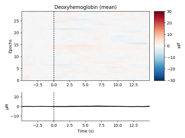 Deoxyhemoglobin (mean)