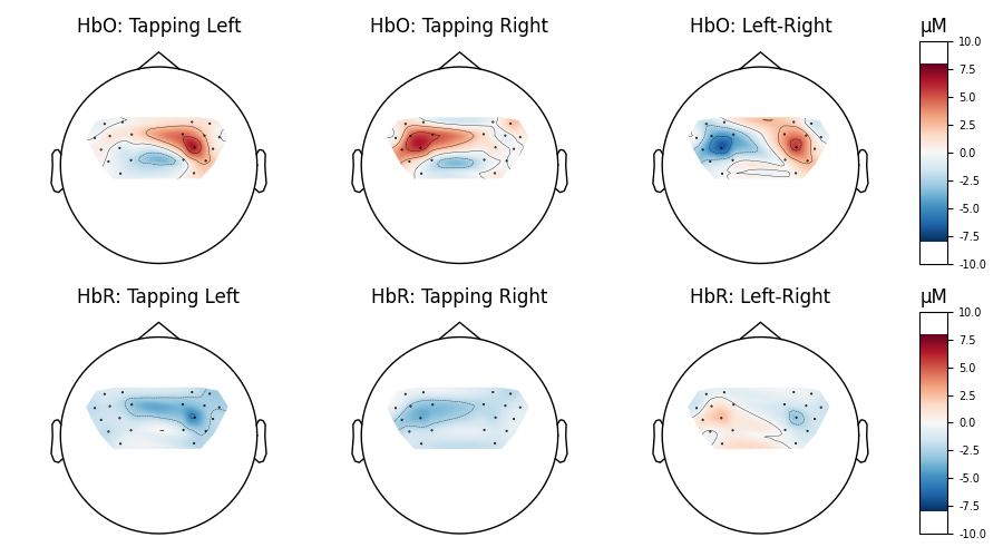 HbO: Tapping Left, HbO: Tapping Right, HbO: Left-Right, µM, HbR: Tapping Left, HbR: Tapping Right, HbR: Left-Right, µM