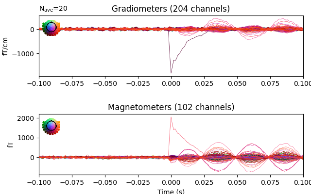 Gradiometers (204 channels), Magnetometers (102 channels)