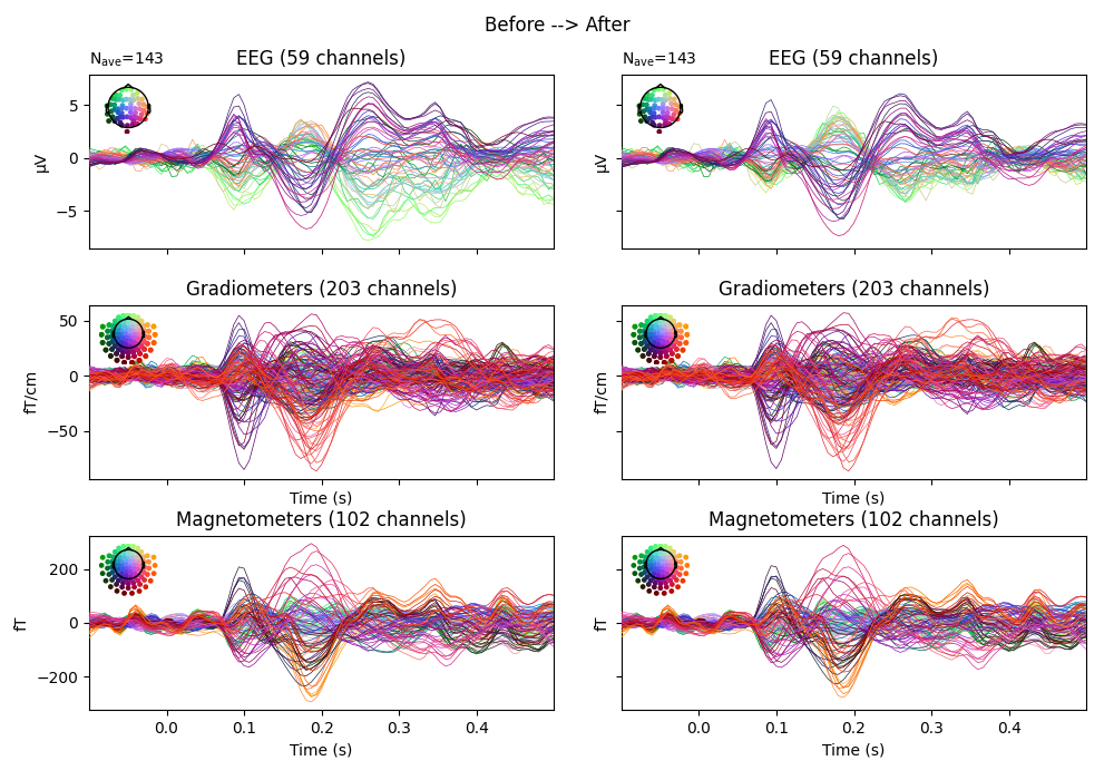 Before --> After, EEG (59 channels), EEG (59 channels), Gradiometers (203 channels), Gradiometers (203 channels), Magnetometers (102 channels), Magnetometers (102 channels)