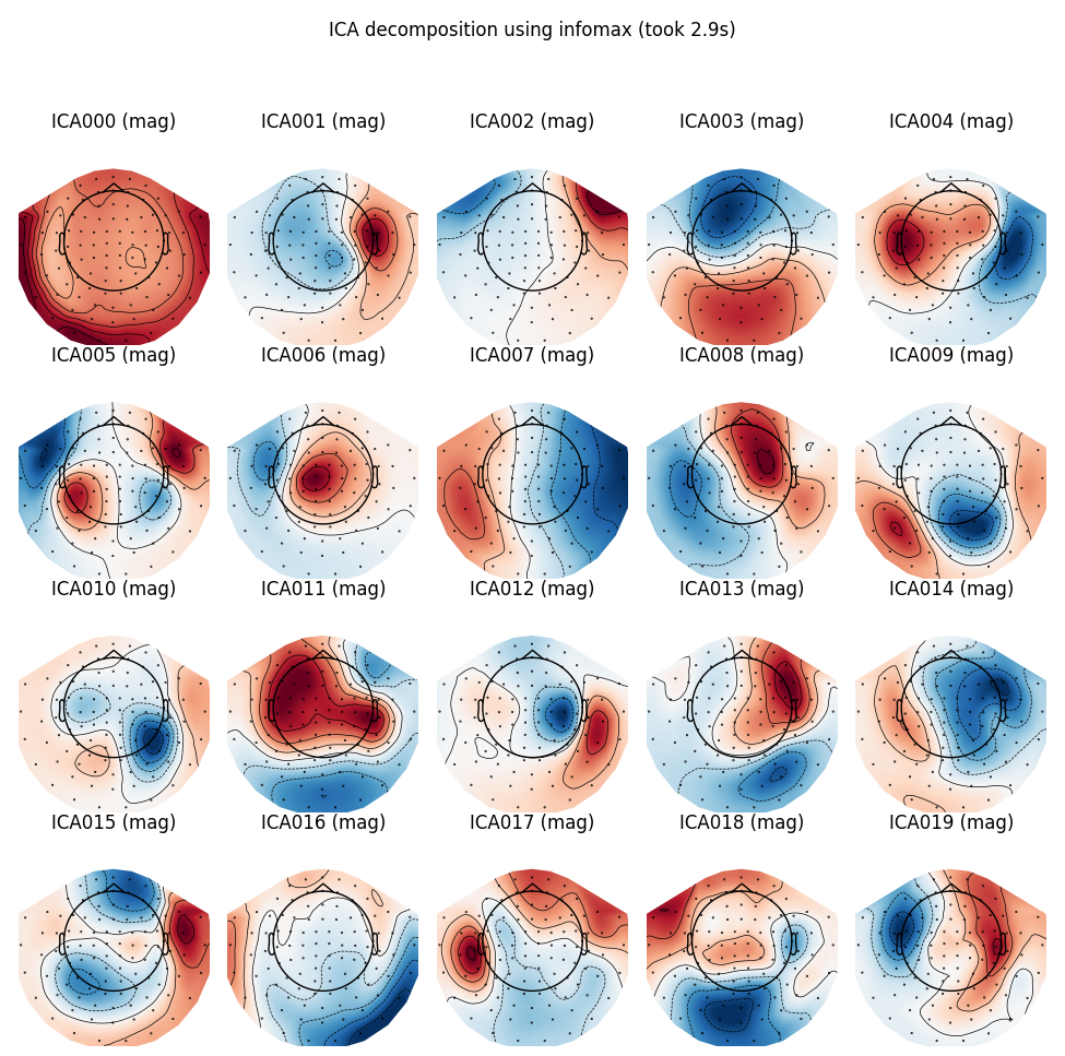 ICA decomposition using infomax (took 2.9s), ICA000 (mag), ICA001 (mag), ICA002 (mag), ICA003 (mag), ICA004 (mag), ICA005 (mag), ICA006 (mag), ICA007 (mag), ICA008 (mag), ICA009 (mag), ICA010 (mag), ICA011 (mag), ICA012 (mag), ICA013 (mag), ICA014 (mag), ICA015 (mag), ICA016 (mag), ICA017 (mag), ICA018 (mag), ICA019 (mag)