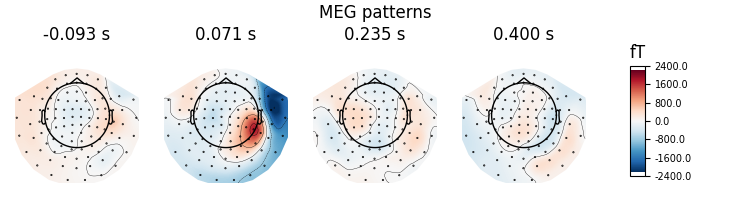 MEG patterns, -0.093 s, 0.071 s, 0.235 s, 0.400 s, fT