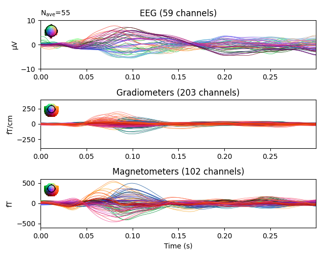 EEG (59 channels), Gradiometers (203 channels), Magnetometers (102 channels)