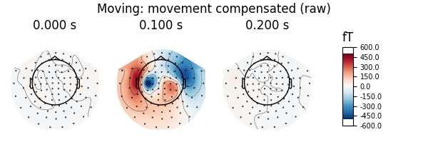 Moving: movement compensated (raw), 0.000 s, 0.100 s, 0.200 s, fT