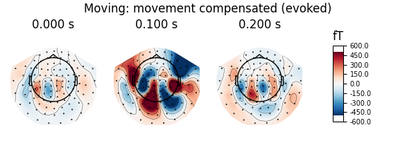 Moving: movement compensated (evoked), 0.000 s, 0.100 s, 0.200 s, fT