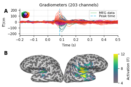 Gradiometers (203 channels)