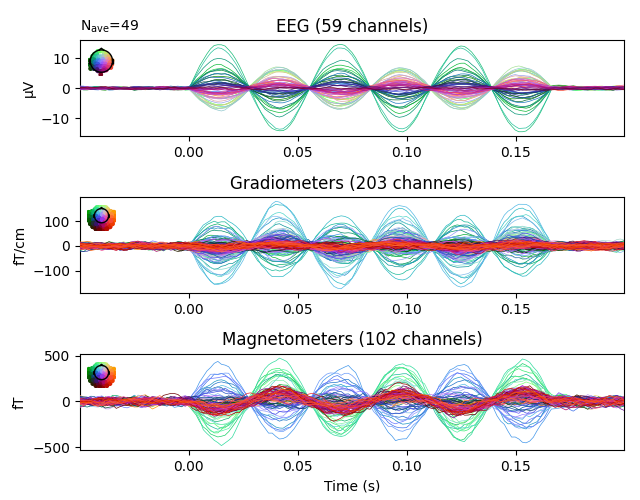 EEG (59 channels), Gradiometers (203 channels), Magnetometers (102 channels)