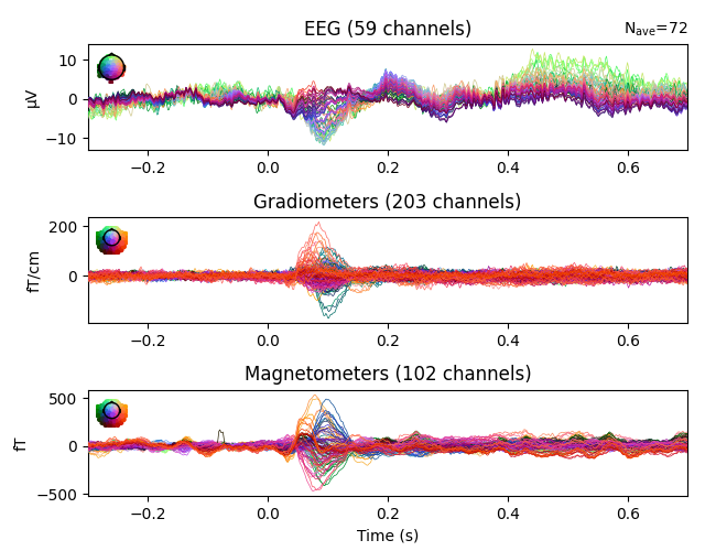 EEG (59 channels), Gradiometers (203 channels), Magnetometers (102 channels)