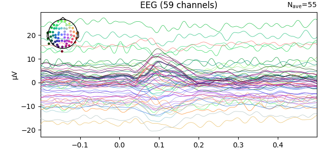 EEG (59 channels)