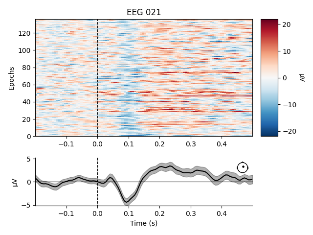 EEG 021