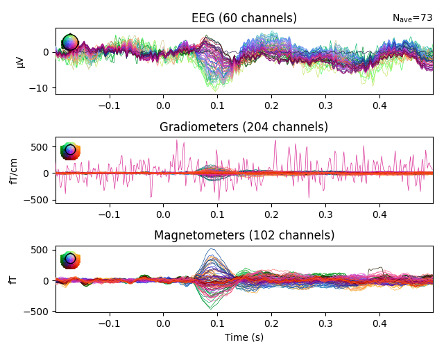 EEG (60 channels), Gradiometers (204 channels), Magnetometers (102 channels)