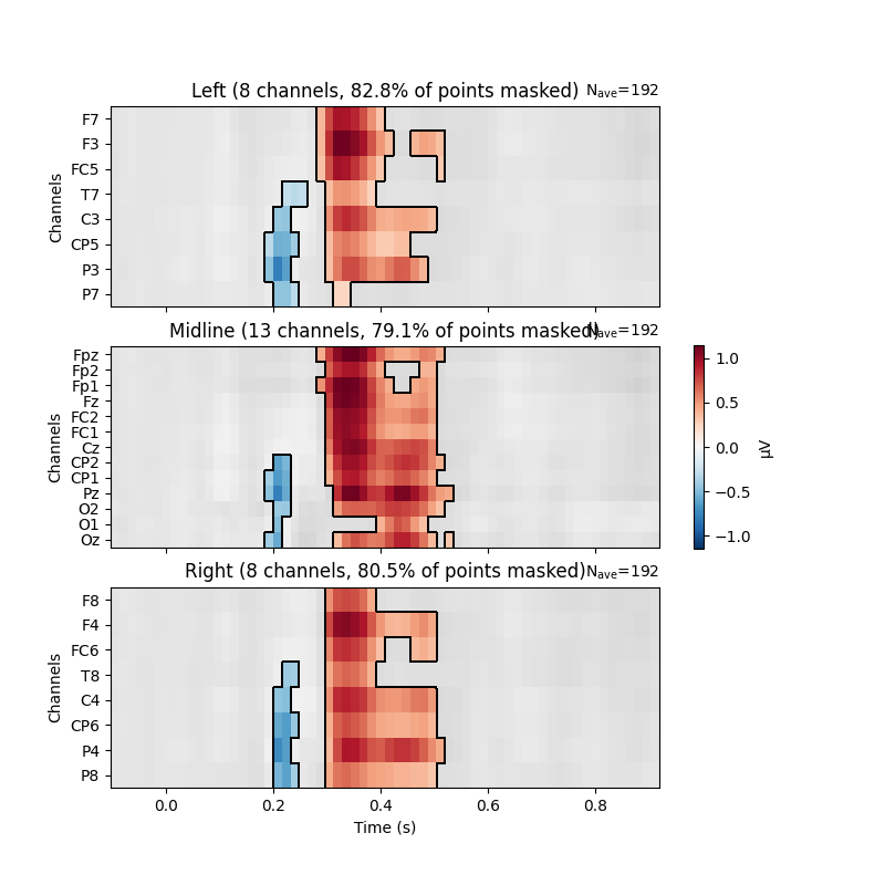 Left (8 channels, 82.8% of points masked), Midline (13 channels, 79.1% of points masked), Right (8 channels, 80.5% of points masked)