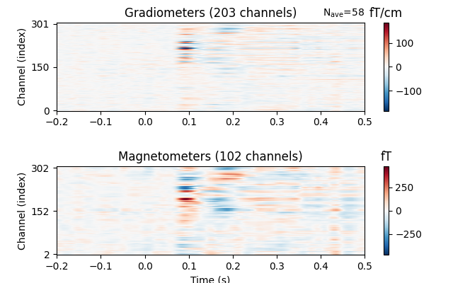 Gradiometers (203 channels), Magnetometers (102 channels), fT/cm, fT