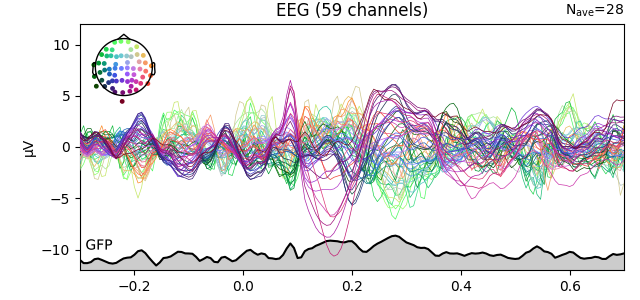 EEG (59 channels)