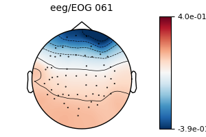 , eeg/EOG 061