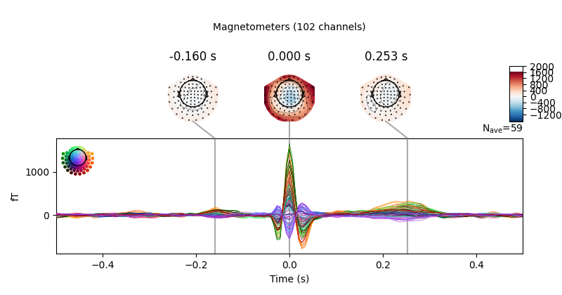 -0.160 s, 0.000 s, 0.253 s