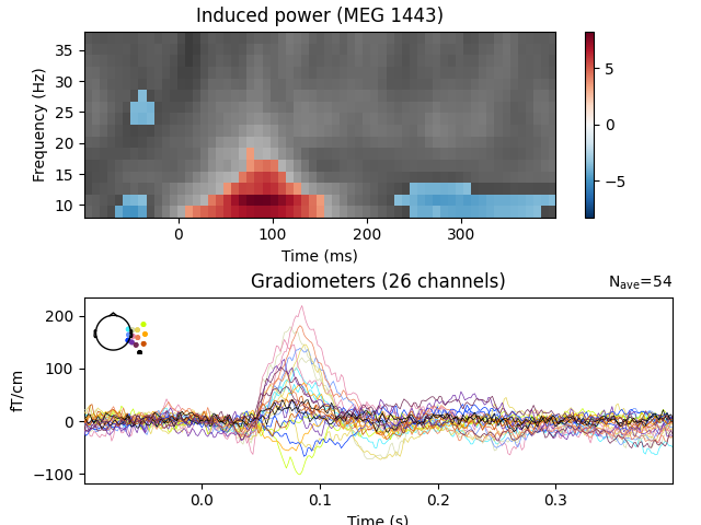 Induced power (MEG 1443), Gradiometers (26 channels)