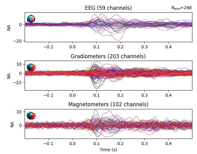 EEG (59 channels), Gradiometers (203 channels), Magnetometers (102 channels)