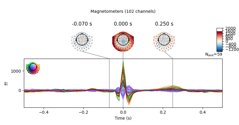 -0.070 s, 0.000 s, 0.250 s