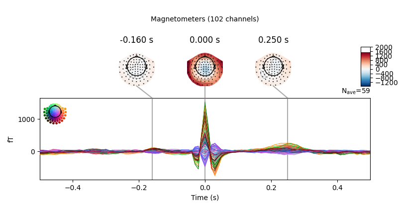 -0.160 s, 0.000 s, 0.250 s