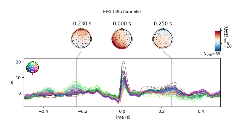 -0.230 s, 0.000 s, 0.250 s