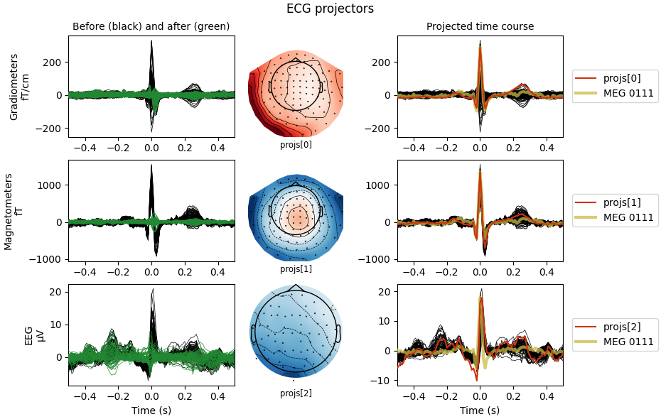 ECG projectors, Before (black) and after (green), Projected time course