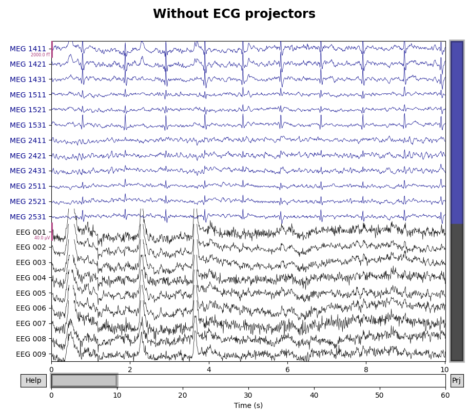 Without ECG projectors