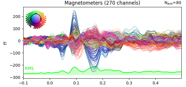 Magnetometers (270 channels)